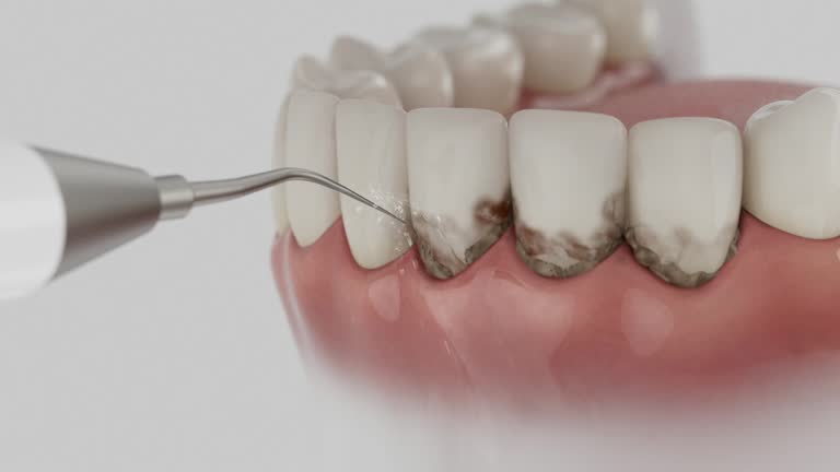 Trusted Dental Crowns And Bridges service in Watergate, FL - Dentist Open Now